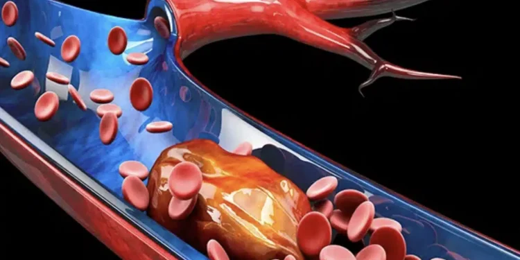 Η υπερτροφή που μπορεί να εμποδίσει τους θρόμβους στον εγκέφαλο και να προστατεύσει την ψυχική σας υγεία