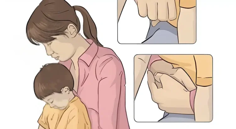 Πνίγεται το παιδί; Η σωτήρια λαβή Χάιμλιχ για την πνιγμονή από τροφή