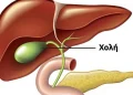 Τι συμβαίνει στο σώμα μετά την αφαίρεση της χοληδόχου κύστης; 3 ασθένειες που μπορεί να ακολουθήσουν – Αποφύγετε τη χειρουργική επέμβαση εάν είναι δυνατόν