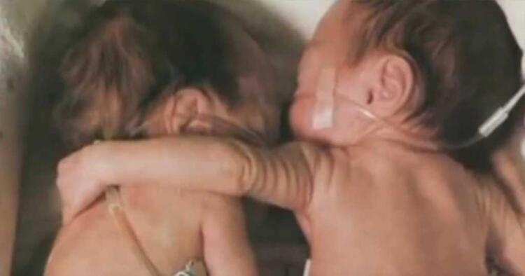 Έβαλε το χεράκι της γύρω από την αδερφούλα της που πέθαινε… Αυτό που συνέβη μετά όμως δεν το περιμέναμε!