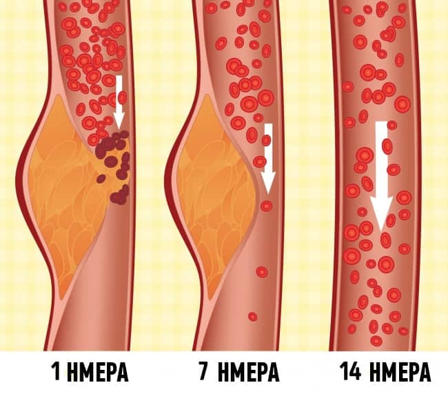 Τι είναι η δίαιτα ΝΤΑΣ και γιατί οι γιατροί την θεωρούν μια από τις καλύτερες για την υγεία 1 114793a910d34cb77747a8b81f274919