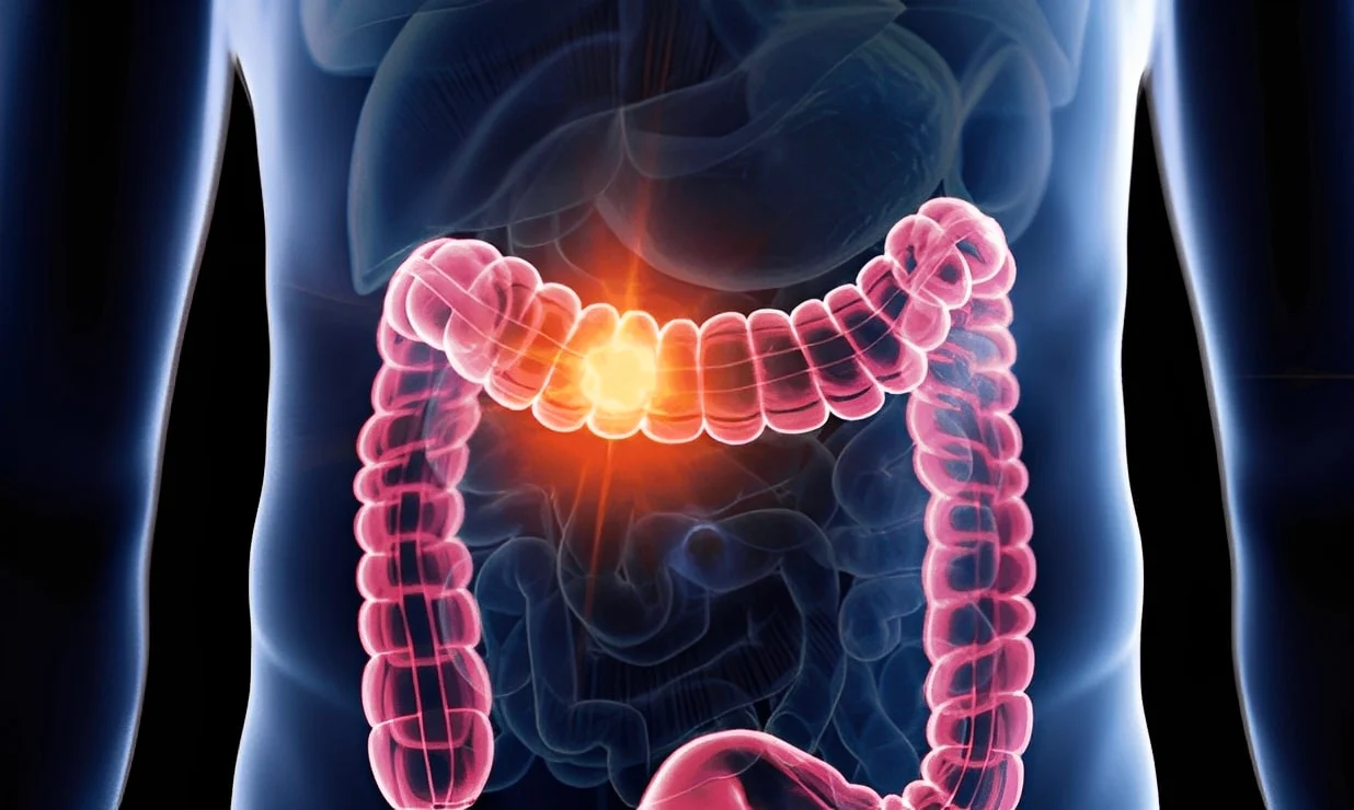 Πώς καθαρίσετε το έντερό σας; Θυμηθείτε αυτό το μυστικό των γιατρών