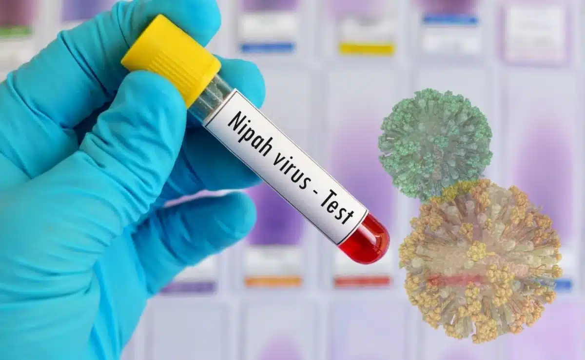 Η νέα έξαρση του ιού Νίπα προκαλεί παγκόσμια ανησυχία στους επιστήμονες 1