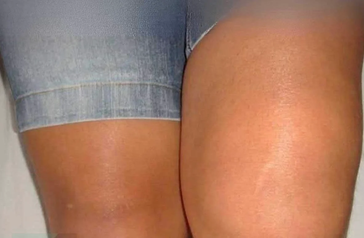 Γιατί το ένα γόνατο είναι πρησμένο αλλά όχι το άλλο;