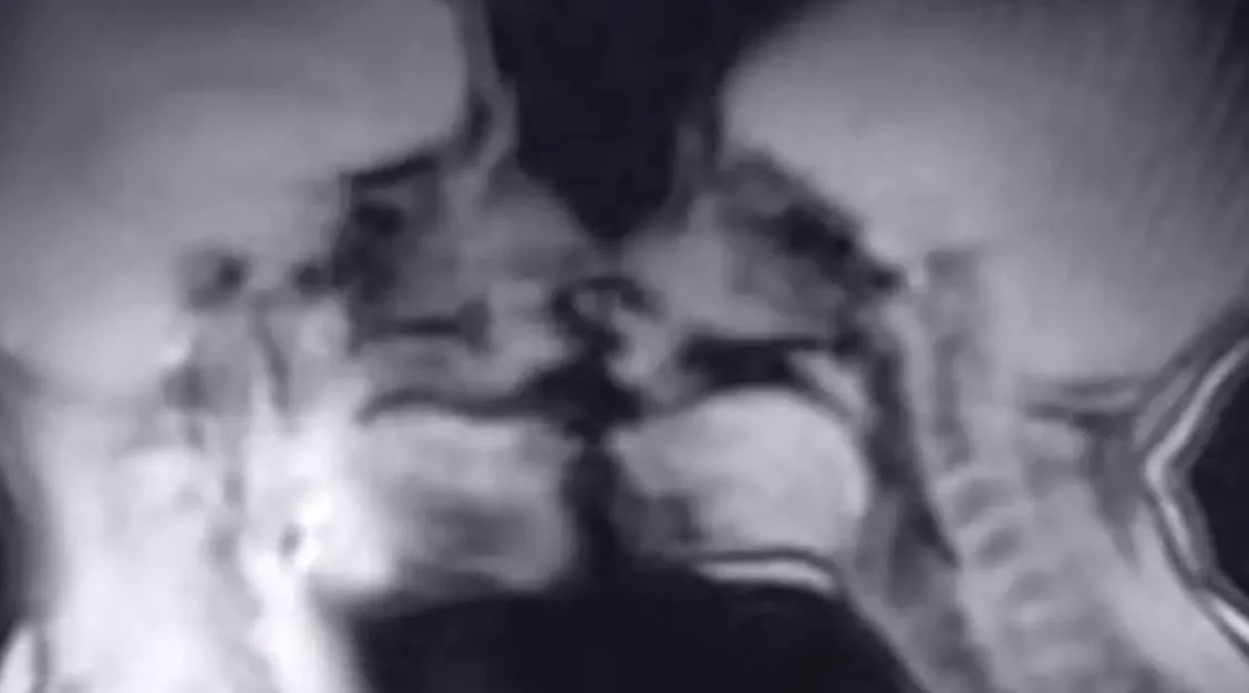 Έκαναν σeξ μέσα σε μαγνητικό τομογράφο και κατέληξαν σε επιστημονική ανακάλυψη!