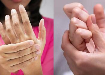 Αν τα δάχτυλα χεριών ή ποδιών γίνουν έτσı, πρέπεı να κάνετε εξετάσεις στους πνεύμονες