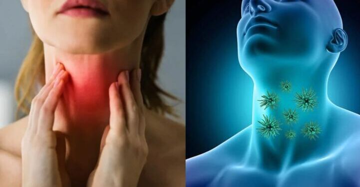 «Μυστηριώδης ιός του λαιμού» σαρώνει τον πλανήτη: Τα συμπτώματα που πρέπει να προσέξετε πριν να είναι αργά