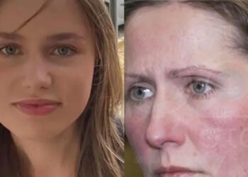 ΕΚΤΑΚΤΟ: Εσπευσμένα στη Γερμανία ο πατέρας της Λόρα – Φόβοι πως…