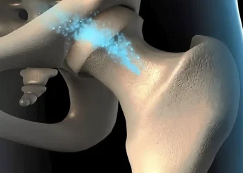 Το φρούτο που προλαμβάνει την οστεοπόρωση – Ποια είναι η ιδανική ποσότητα