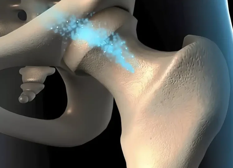 Το φρούτο που προλαμβάνει την οστεοπόρωση – Ποια είναι η ιδανική ποσότητα