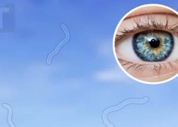 Οφθαλμίατρος αποκαλύπτει τι να κάνετε αν αρχίσετε να βλέπετε «μυγάκια»