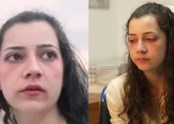 Ισπανία: Η Νοέλια Καστίγιο μόλις 25 ετών, πέθανε – Όλος ο πλανήτης δάκρυσε με την ιστορία της