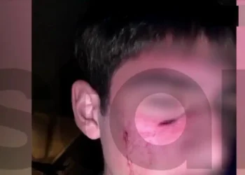 Άγριο bullying στα Τρίκαλα: 16χρονος κοπάναγε το κεφάλι συνομήλικού του σε αυτοκίνητο επειδή δεν του άρεσαν τα ρούχα του – «Πάμε πιο πέρα που δεν έχει κάμερες, θα σε σκοτώσω!»
