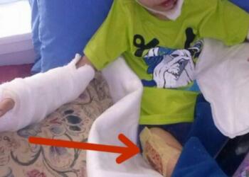 7χρονος ούρλιαζε από τον πόνο και οι γείτονες πήραν την αστυνομία – Έπαθαν σοκ με αυτό που αντίκρισαν
